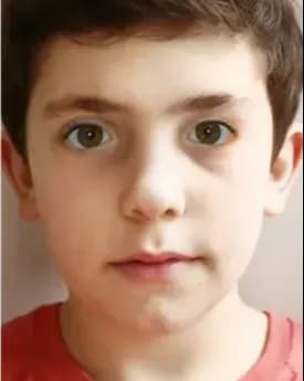 डिजिटल थेरेपी अंतराल स्ट्रबिज्म के लिए